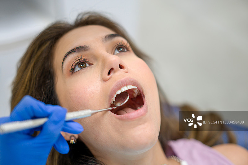 在牙医处张开嘴做牙齿检查的患者图片素材
