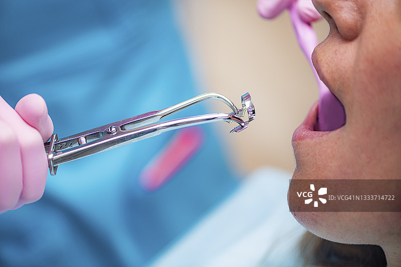 牙髓病学图片素材