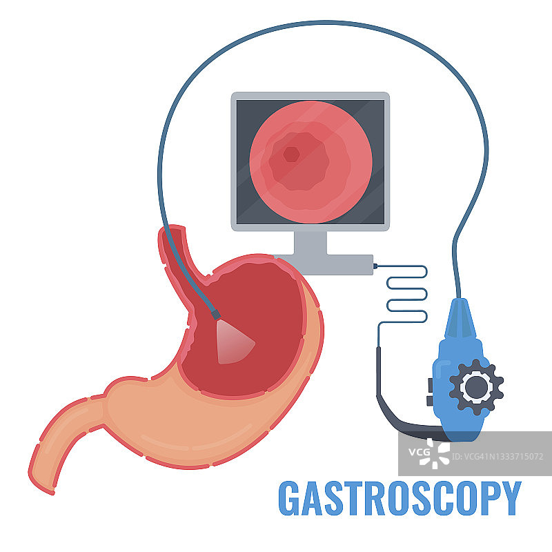 胃镜检查概念图图片素材