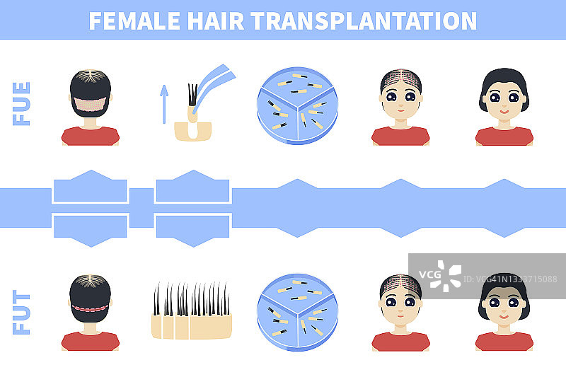 女性植发插图图片素材