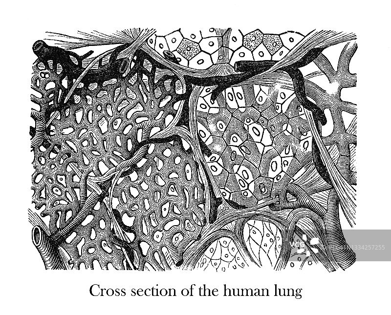 显微镜下观察的人类肺部古老雕刻插图图片素材