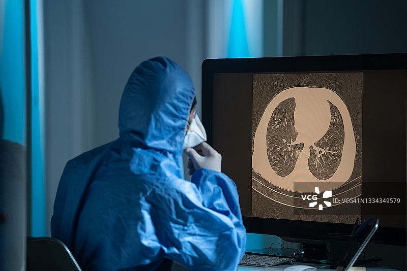 放射科医生在放射科诊所检查患者的胸部CT图像图片素材