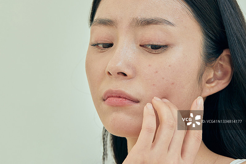 女人为皮肤问题感到压力图片素材