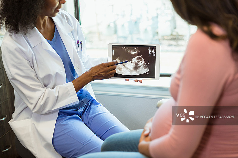 医生指向数字平板电脑上的超声波图像图片素材