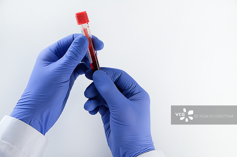 医生或实验室助理手持试管中的血液样本测试，白色背景或桌子，维护和检查健康的概念，通过医学检查是否存在疾病和病毒抗体图片素材