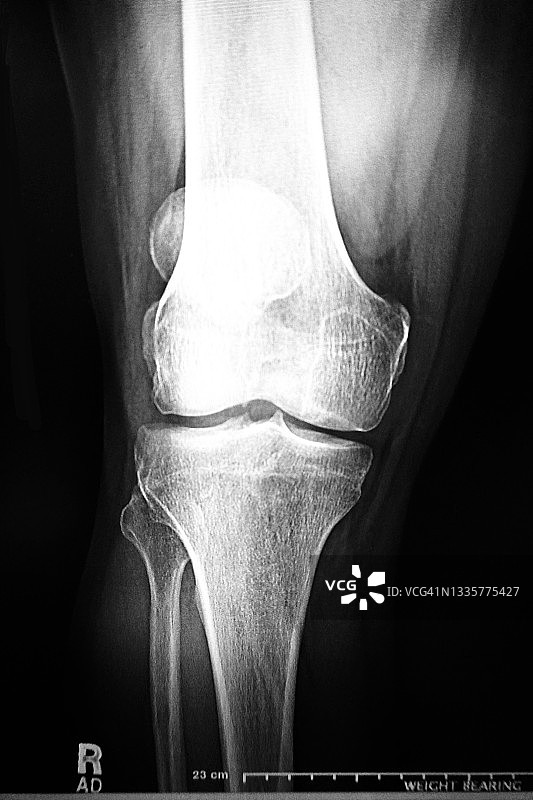 人体X光图像图片素材