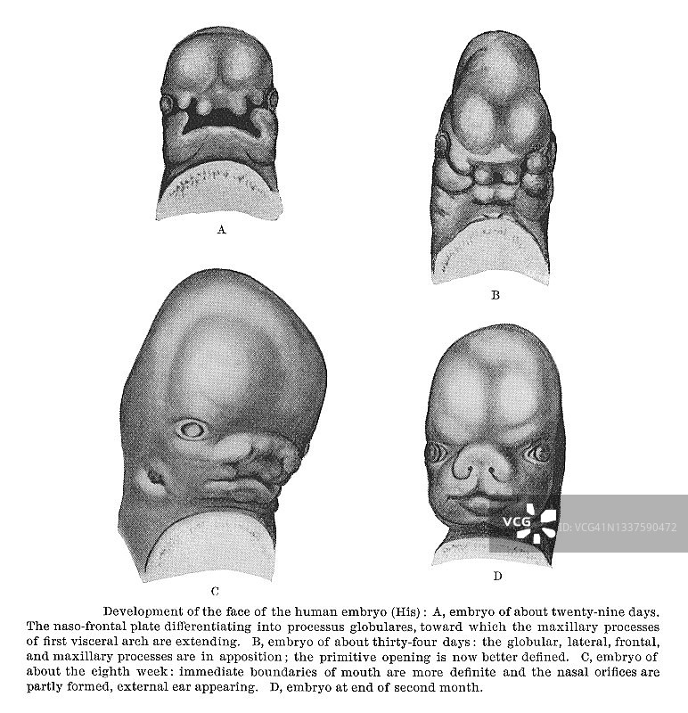 人类胚胎面部发育的老式雕刻插图图片素材