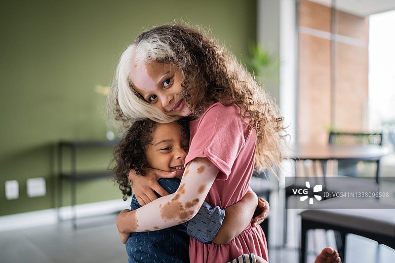 在家中拥抱的兄弟姐妹肖像，白癜风女孩图片素材