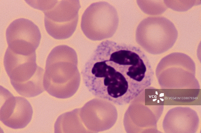 正常血涂片（人）：红细胞和白细胞（嗜中性粒细胞），640倍图片素材