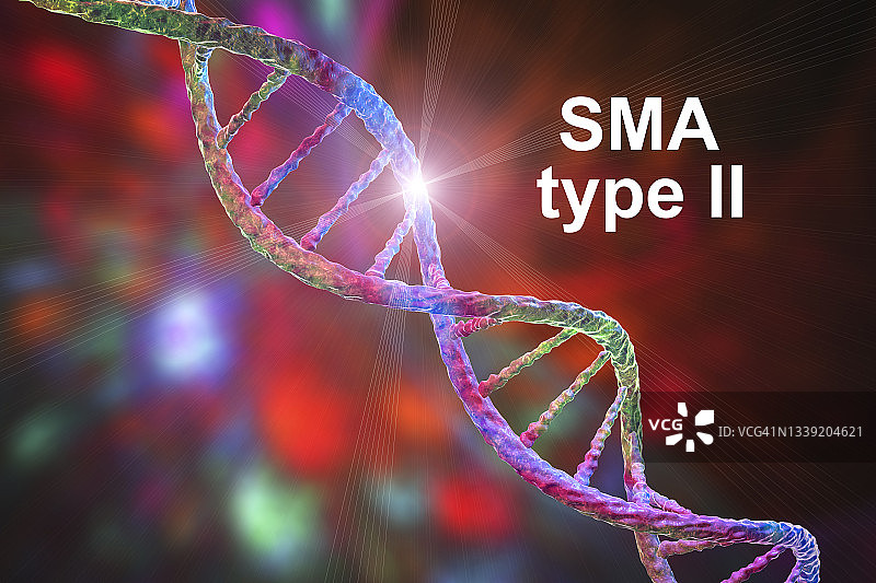 脊髓性肌萎缩症插图图片素材