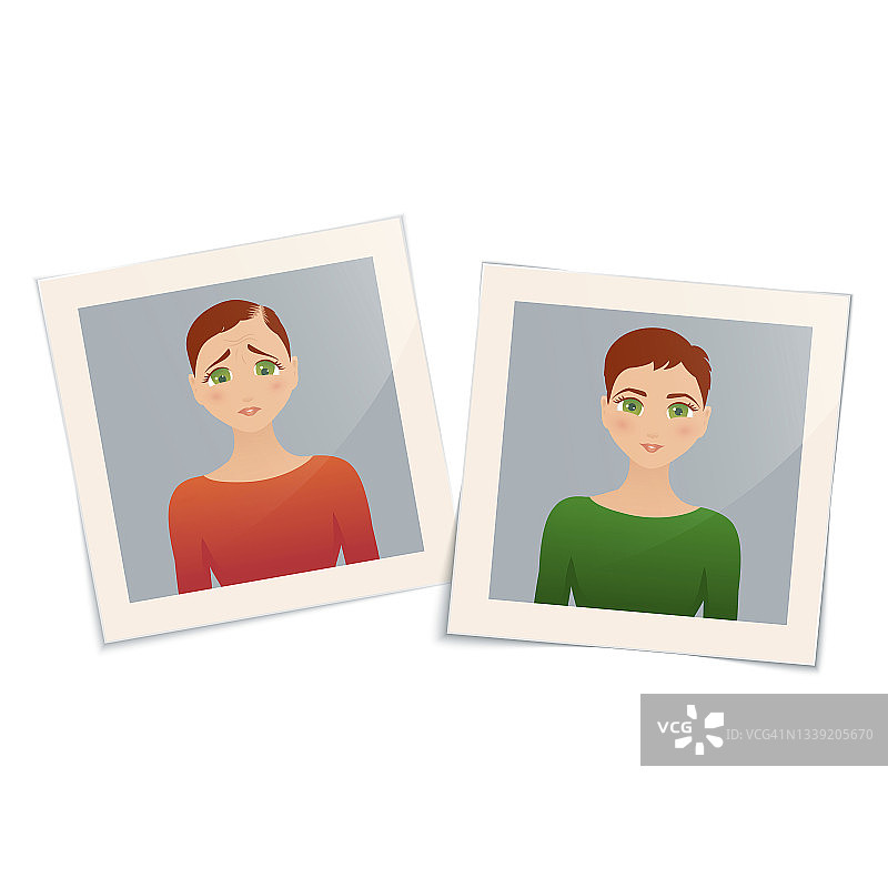 女性脱发治疗概念插图图片素材