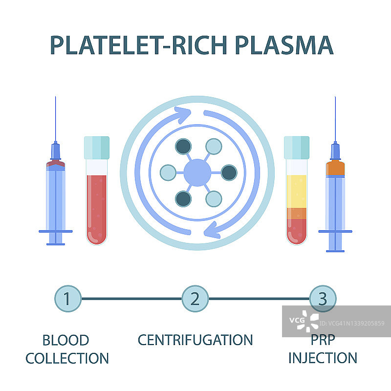 富血小板血浆疗法图示图片素材