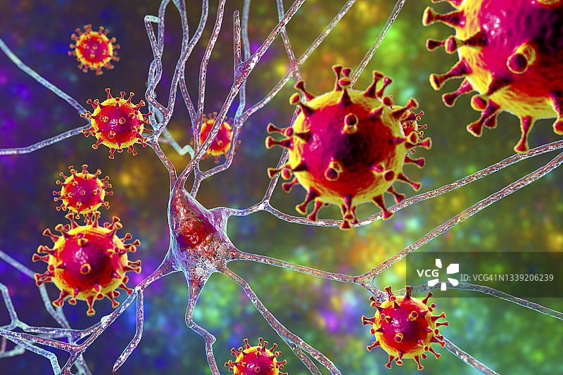 病毒性脑炎概念图图片素材