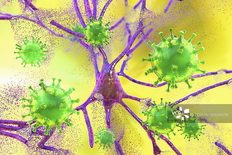 病毒性脑炎概念图图片素材