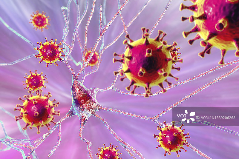 病毒性脑炎概念图图片素材