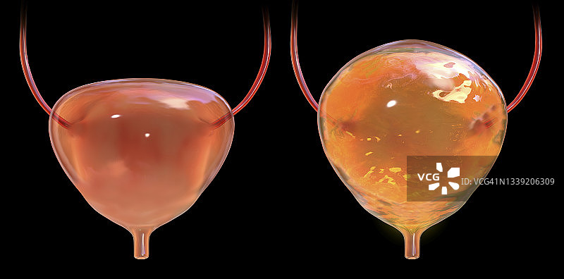 膀胱插图图片素材