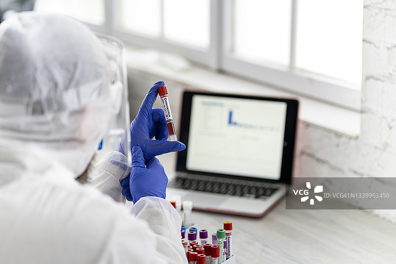 实验室背景上的新冠病毒血液样本图片素材