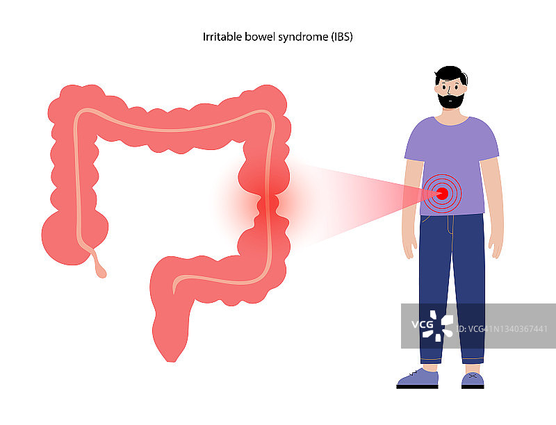 肠易激综合征图片素材