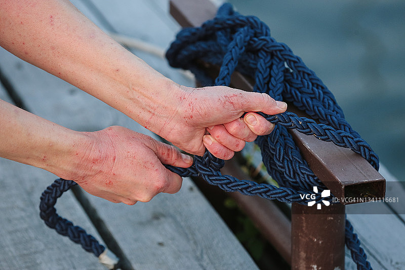 航海课程后，手部皮肤有划痕的女性的裁剪视图图片素材