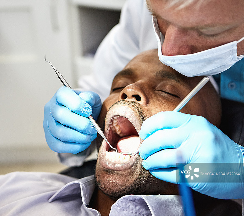牙医检查张开嘴的病人图片素材