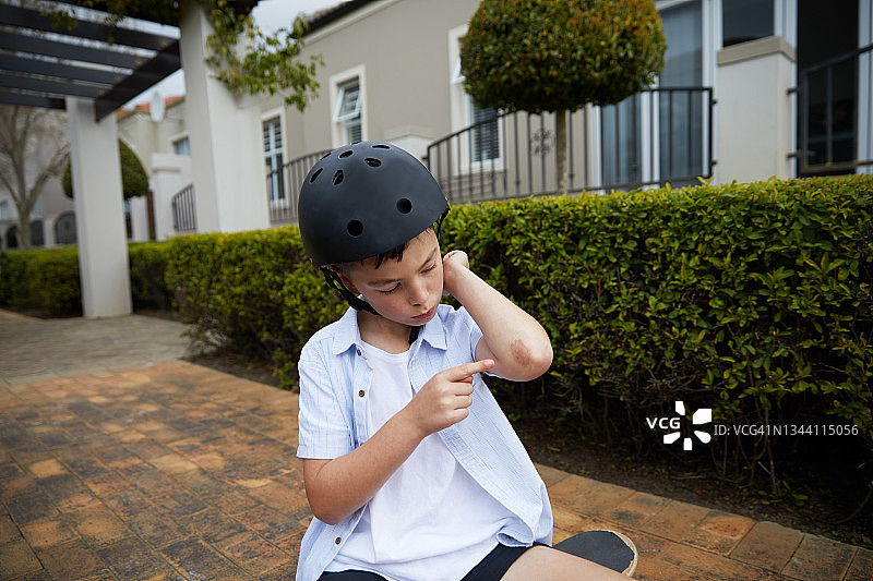 看看我的手肘图片素材