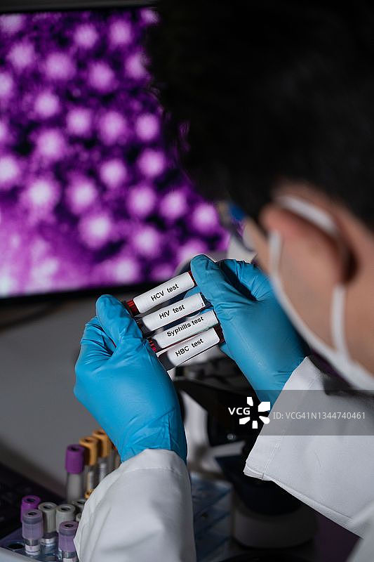 多发性硬化症测试图片素材