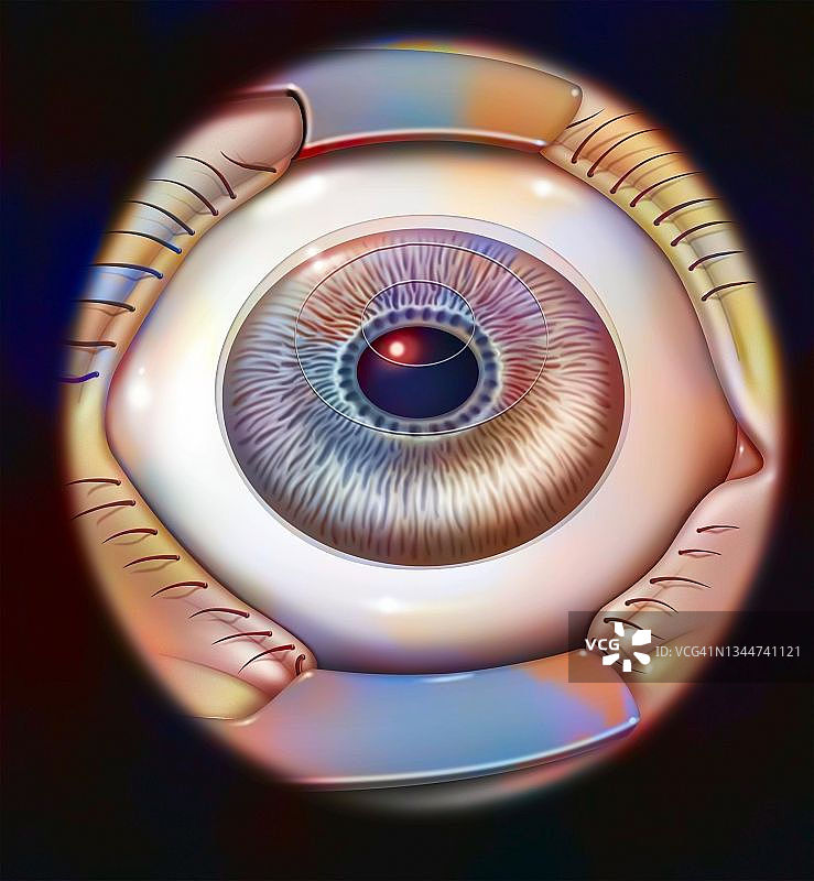 老花眼矫正术图片素材