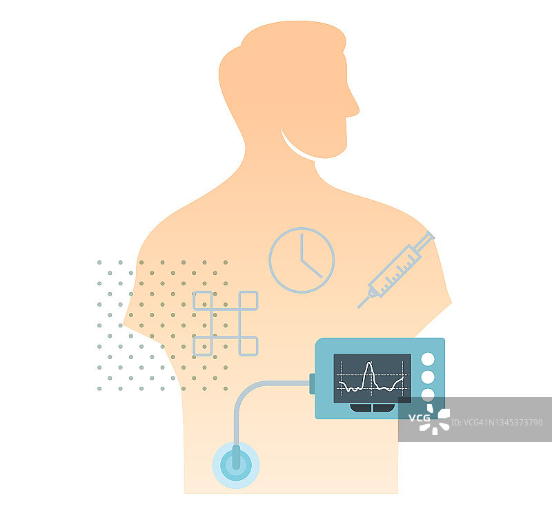 糖尿病胰岛素泵—库存插图图片素材