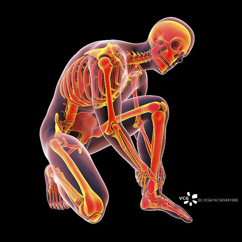 疼痛的脚踝插画图片素材