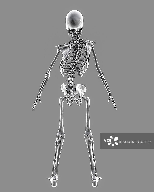 脊柱侧弯插图图片素材