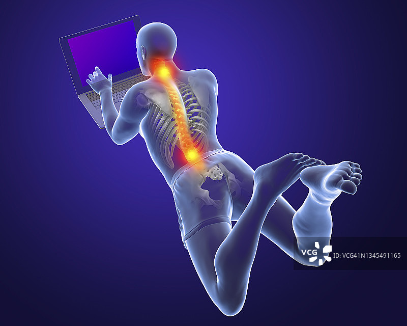 使用笔记本电脑的错误姿势插图图片素材