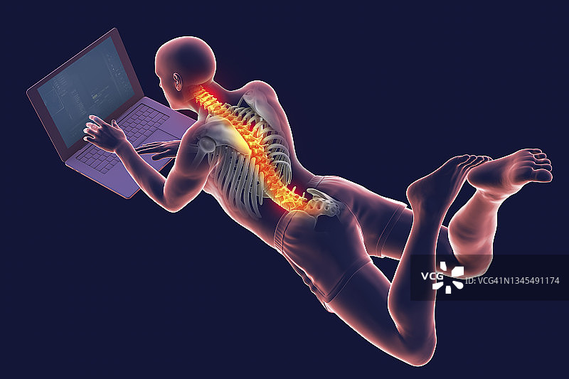使用笔记本电脑的错误姿势插图图片素材