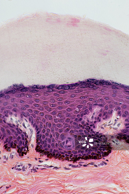 表皮层，基底层中的黑素细胞，人类角质化（厚）皮肤，100倍图片素材