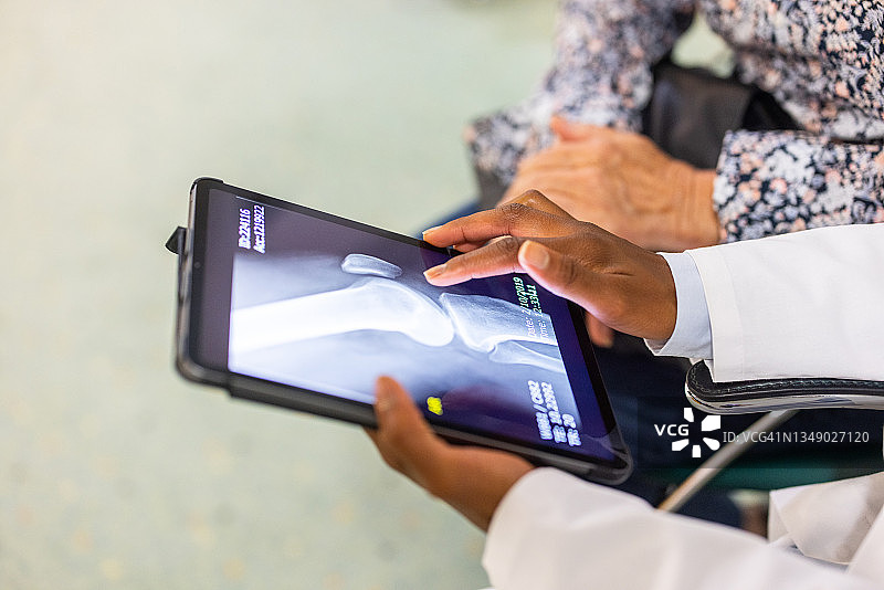 医生在平板电脑上与病人分享X光扫描治疗方案的特写图片素材