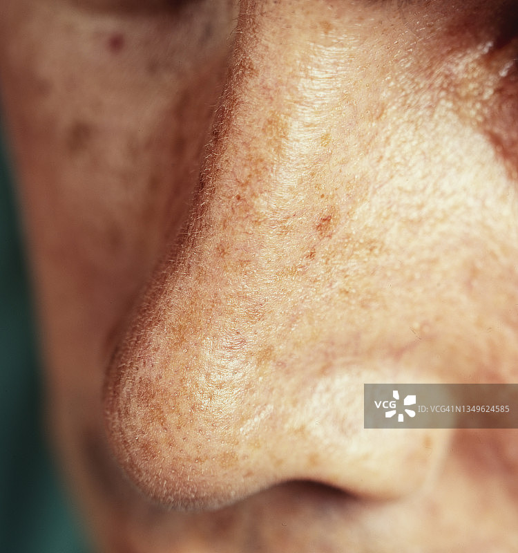 鼻子肌肤特写图片素材