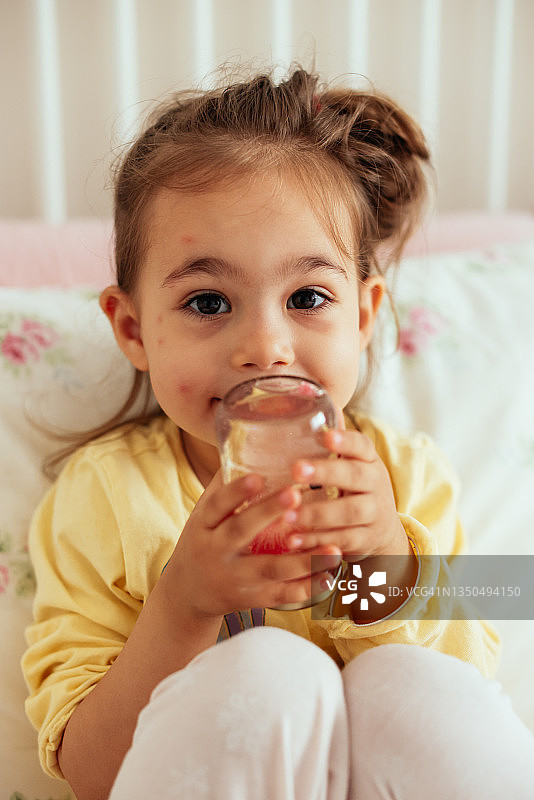 儿童病毒感染或过敏，小女孩身上出现红色麻疹图片素材
