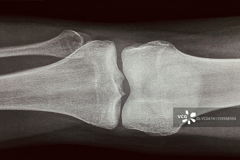 X光照片特写镜头图片素材