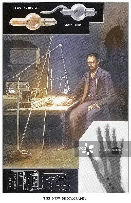 老式雕刻插图：早期伦琴X射线设备图片素材