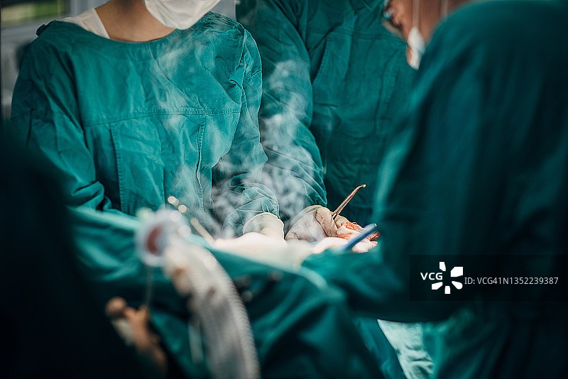 进行手术的外科医生团队图片素材