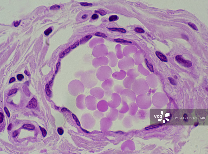 静脉横截面：内皮和管腔内红细胞，250倍图片素材