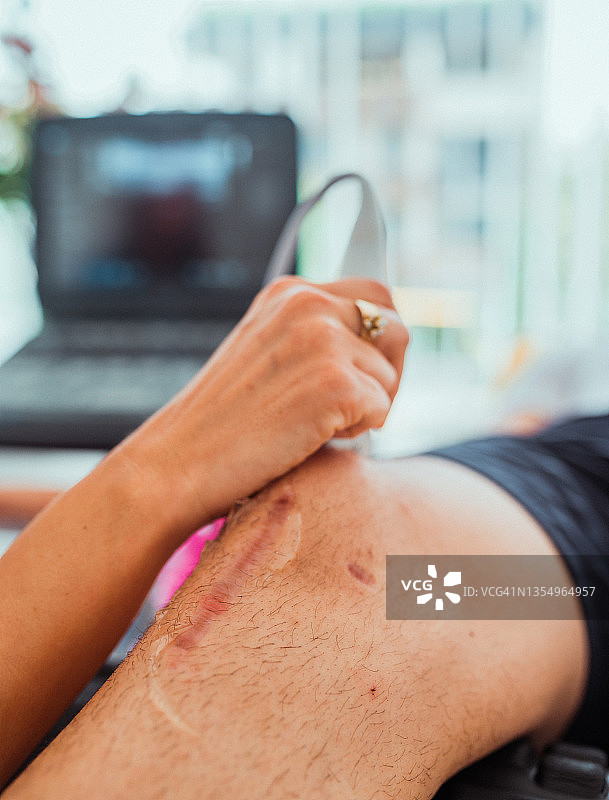 在诊所使用超声扫描仪为男性进行膝关节超声检查图片素材