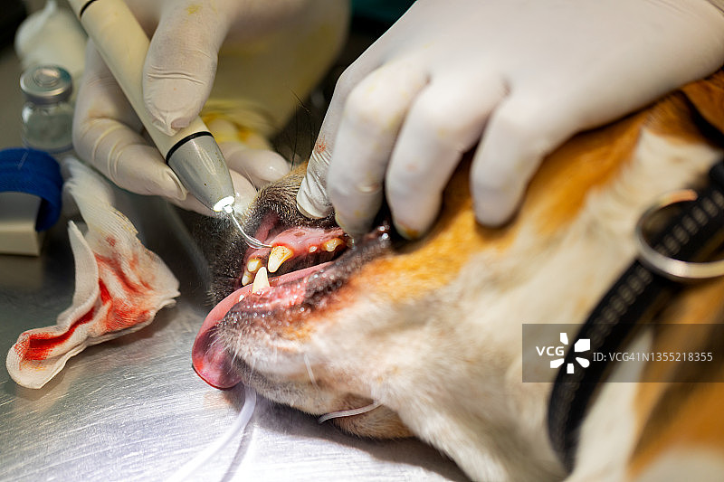 使用超声波洁牙器清除牙垢图片素材