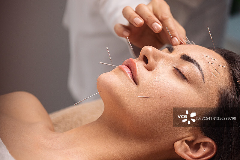 面部针灸治疗图片素材