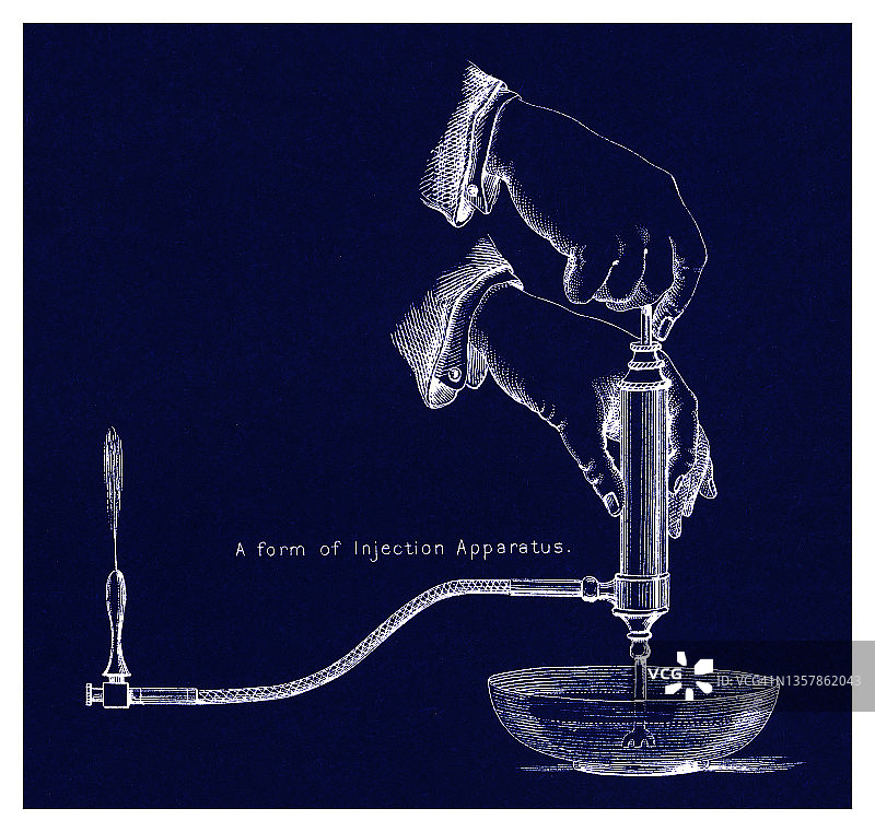 注射器械旧版画插图图片素材