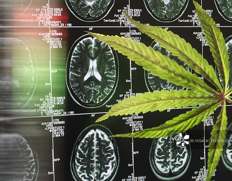 脑部扫描中的大麻叶，用于治疗痴呆症和阿尔茨海默病图片素材