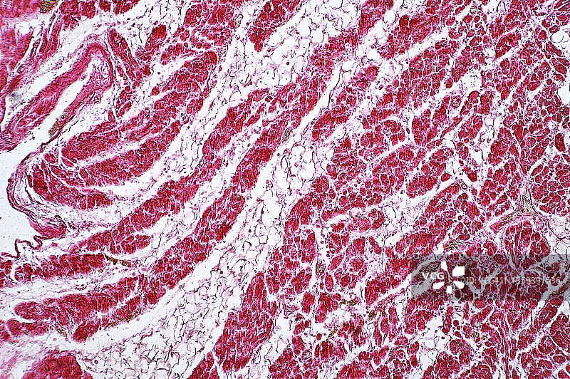 脂肪心光显微照片图片素材