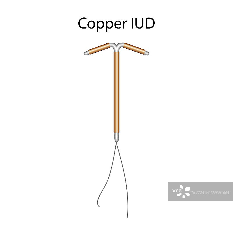 铜制宫内节育器插图图片素材