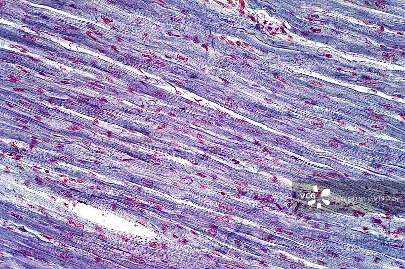 人类心肌的光学显微照片图片素材
