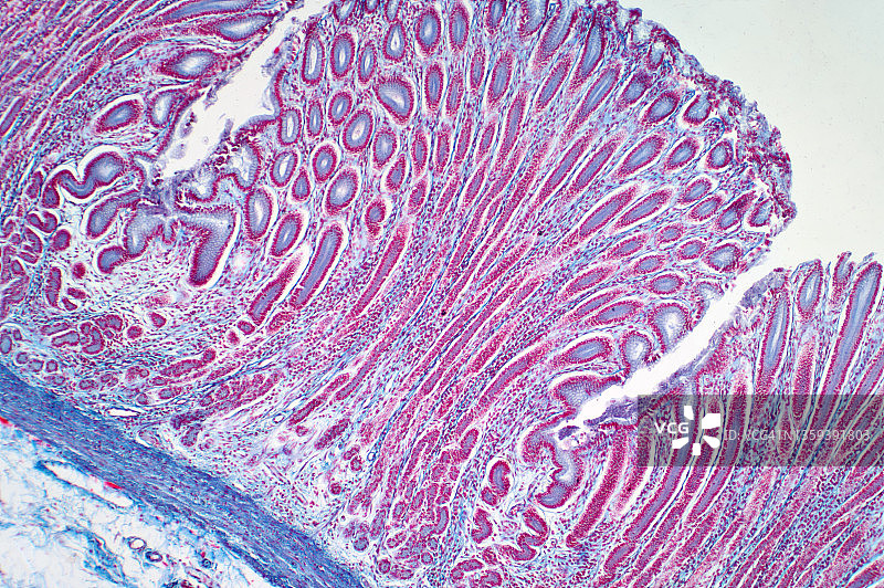 结肠活检显微照片图片素材