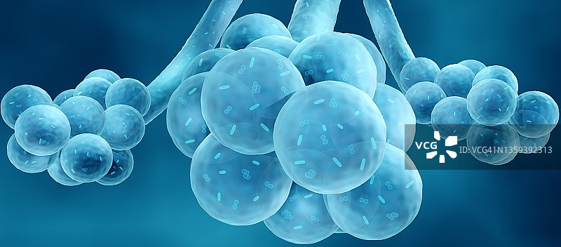 细菌性肺炎插图图片素材